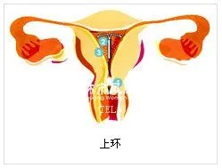 北京社保缴费基数 北京社保上环