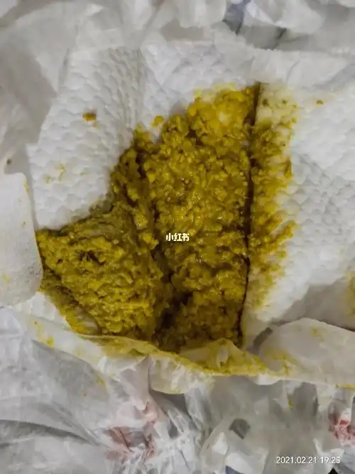 奶粉宝宝,奶瓣一直拉这么多,正常吗?