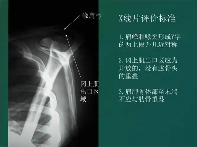 一文了解肩部x线片拍摄方法