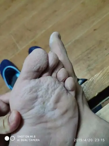 脚有脚气,用什么药好一点,不痒,就是爱出汗,脚臭