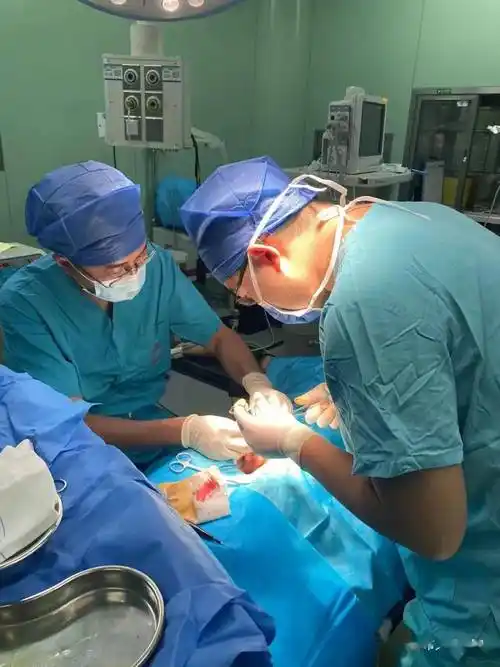 【技术】包皮环切吻合器为患者解除后顾之忧_手术_男性_治疗