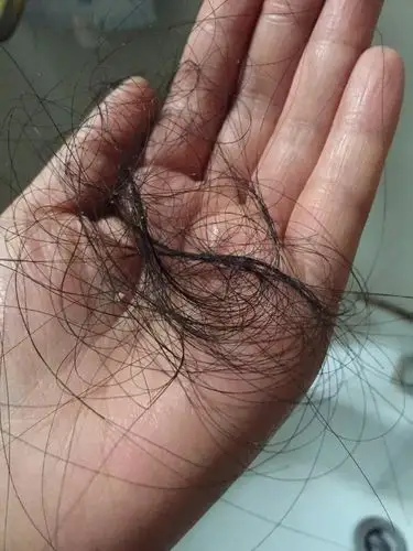 生完宝宝后,掉发好严重啊