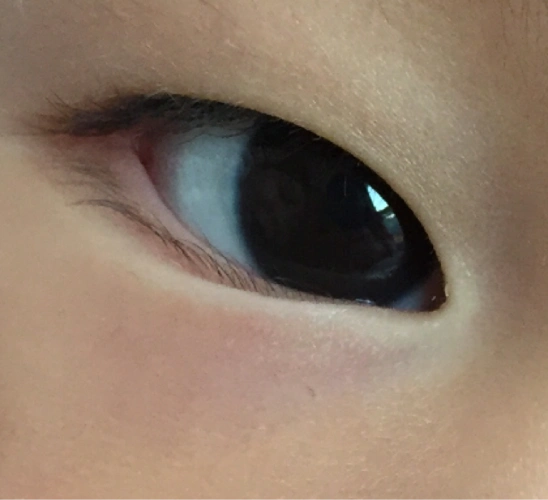 [2014年4月妈妈帮]宝宝的眼睛