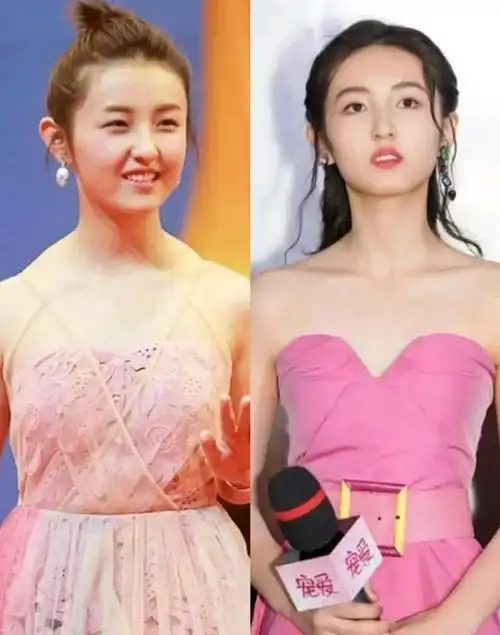 斜方肌真的是"瑕疵放大器"?如何缓解斜方肌拥有直角肩?