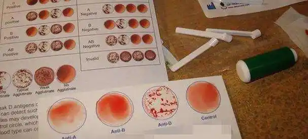 血液是否相容的场景,当然现实生活中测定自己的血型需要进行凝集反应