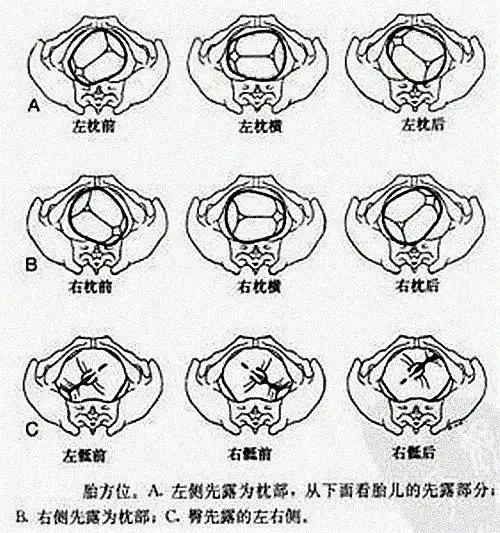 什么是胎方位示意图_有来医生