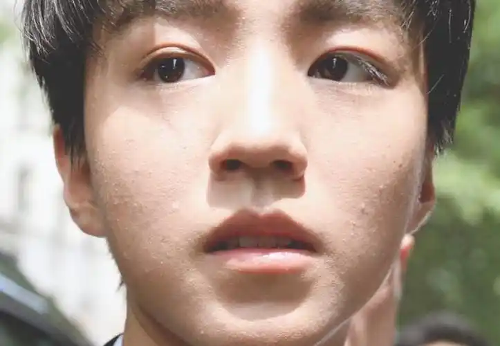 粉底也遮不住王俊凯的粉刺和痘痘粉丝化妆师能不能用点心