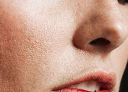年纪轻轻,毛孔粗大皮肤老得像个40岁女人一样,该怎么办?