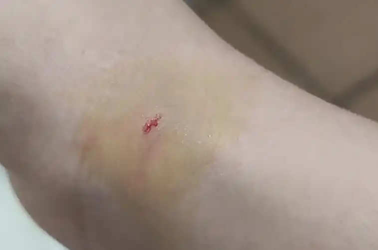 猫喜欢咬人怎么办?