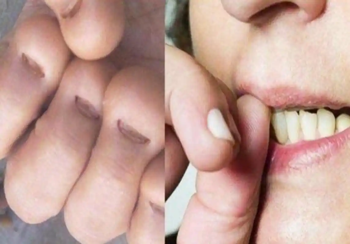 原创经常咬指甲的孩子长大后是什么样三种结局很残酷趁早改