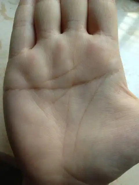 右手手相,女,生命线很短怎么办?断掌