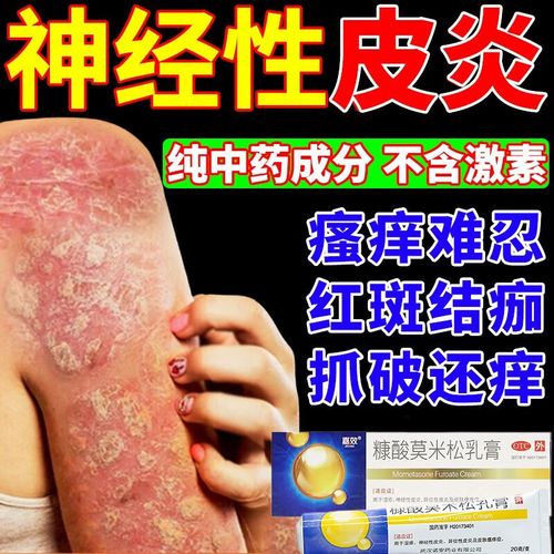 皮炎湿疹皮癣真菌感染止痒膏康酸糯米松软膏神经性皮炎专用药糖酸糠酸