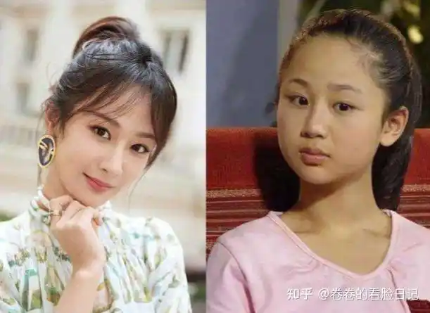 杨紫的脸集合了多少整容误区