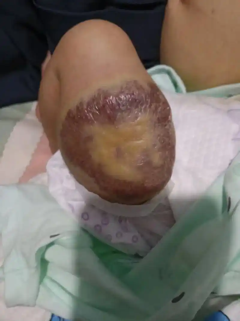 这是我亲妹家的小儿子,麻烦大家帮帮他,宝宝从出世