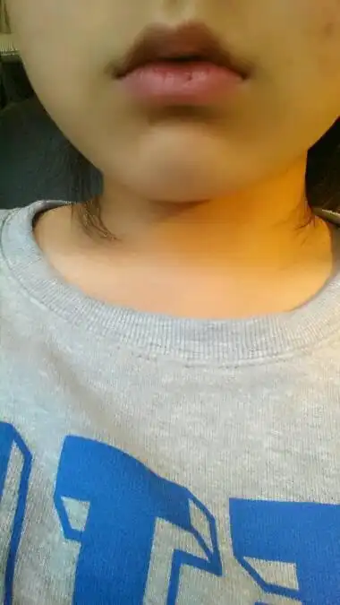 4 2011-01-24 我是一个女生,脸上肉肉的,身体上的肉倒不多,怎养才能