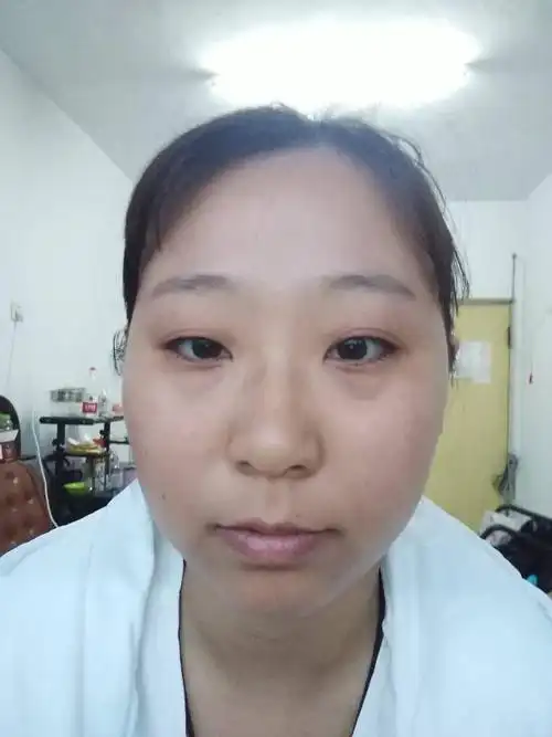 我这个耳朵是外翻的耳朵吗,面相如何