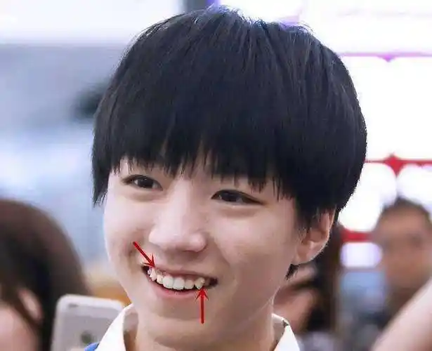 帅气的王俊凯在大笑的时候暴露的缺点让人尴尬拉低了颜值