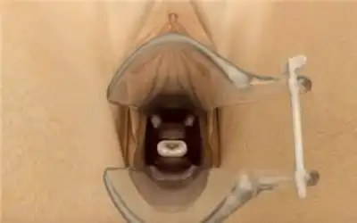 产后不想再要孩子是上环还是买避孕套看完上环全过程你就知道了