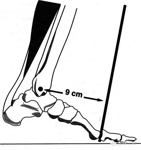 图解——足踝生物力学