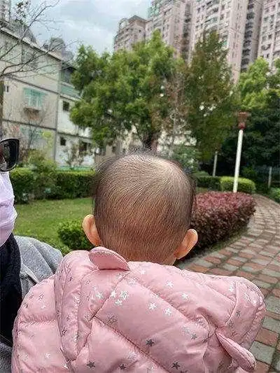 想让宝宝睡出一个漂亮头型,尽量在满月之前干预!