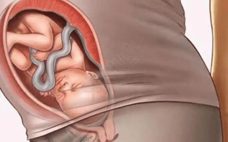 科普一分钟看完顺产全过程这7个步骤是关键