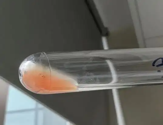 选取人源b型血浆(含人源抗-a)与患者红细胞反应,发现两次为阴性不凝集