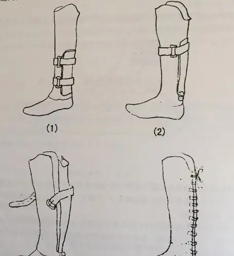 什么是赛姆假肢,有什么特点
