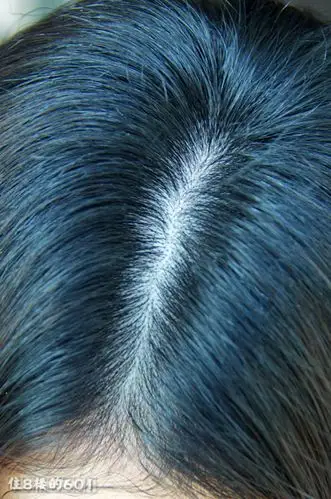 洗后第二天,没头屑,头皮健康.