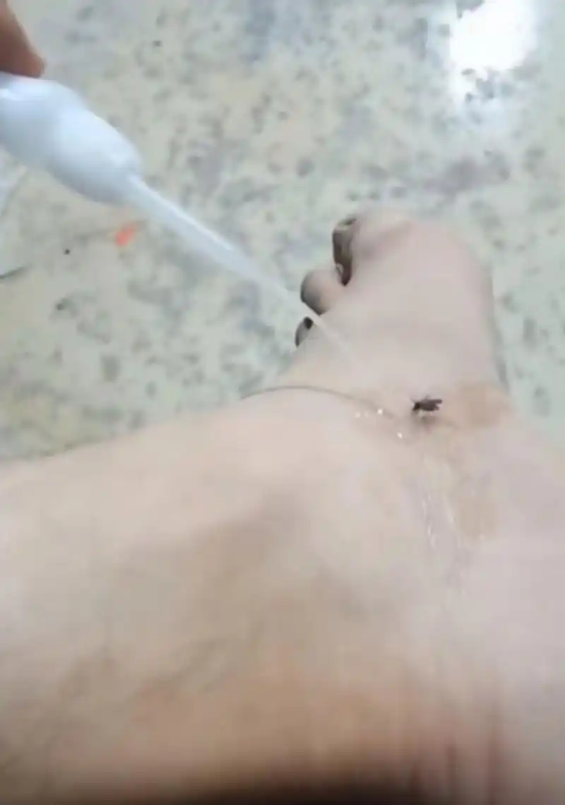 我今天非得用502在脚上做个标本出来