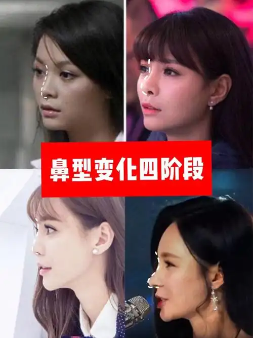 6015从路人脸到女明星,沈梦辰原来整了这么多7193从3_圈子