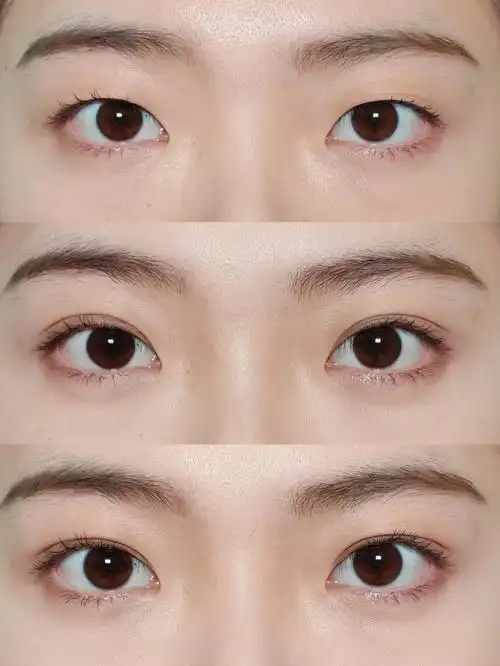 单眼皮姐妹们你们要的双眼皮贴教程来咯