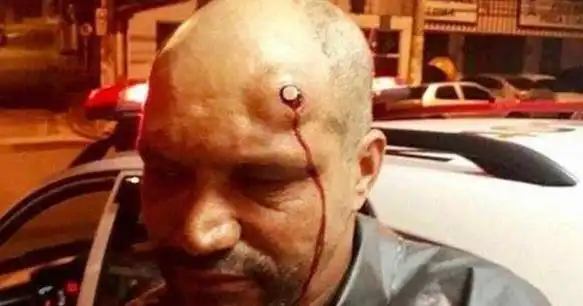 他头部中枪大难不死,坚持跑完马拉松比赛,最后还因祸得福