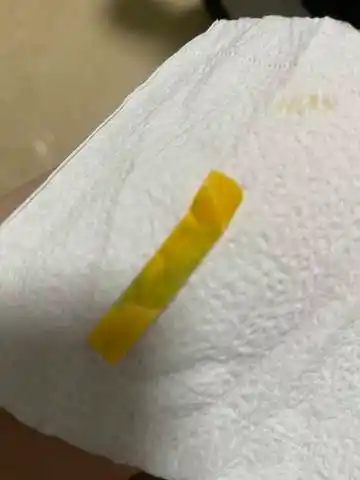 ph试纸测出来这样是不是漏羊水啊