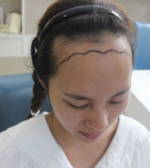 波浪形的发际线还可以拥有美人尖哦