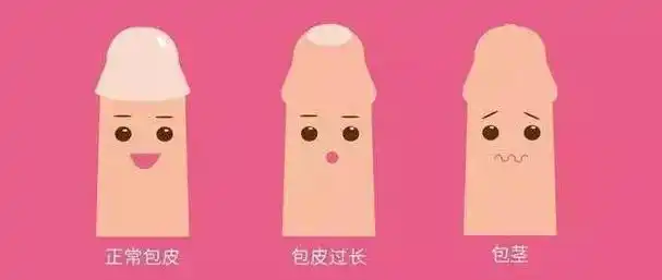 龟头炎,导致包皮内板与龟头差异水平粘连者或继发疤痕性包茎