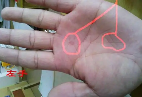 看看你的手掌  掌纹有这症状竟是癌症信号