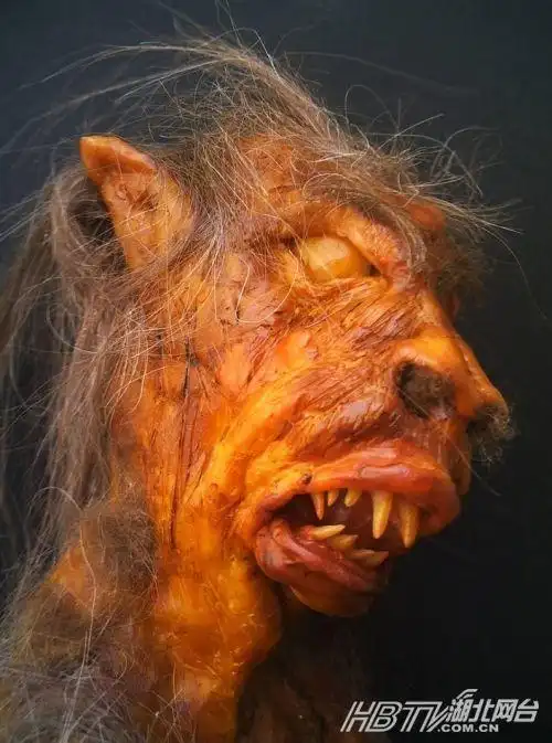 男子k歌太好听惨遭群殴"情歌对唱"致五级伤残