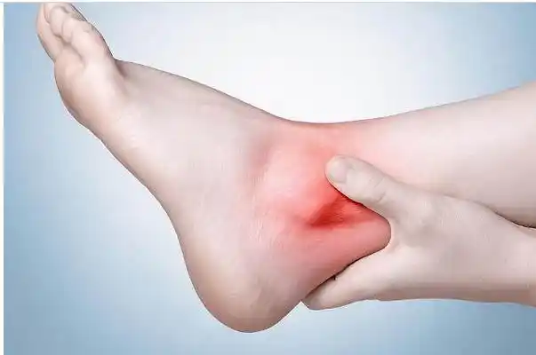 痛风在藏医意为以两个肘关节和两个脚拇指为主要发病点的疾病,藏语