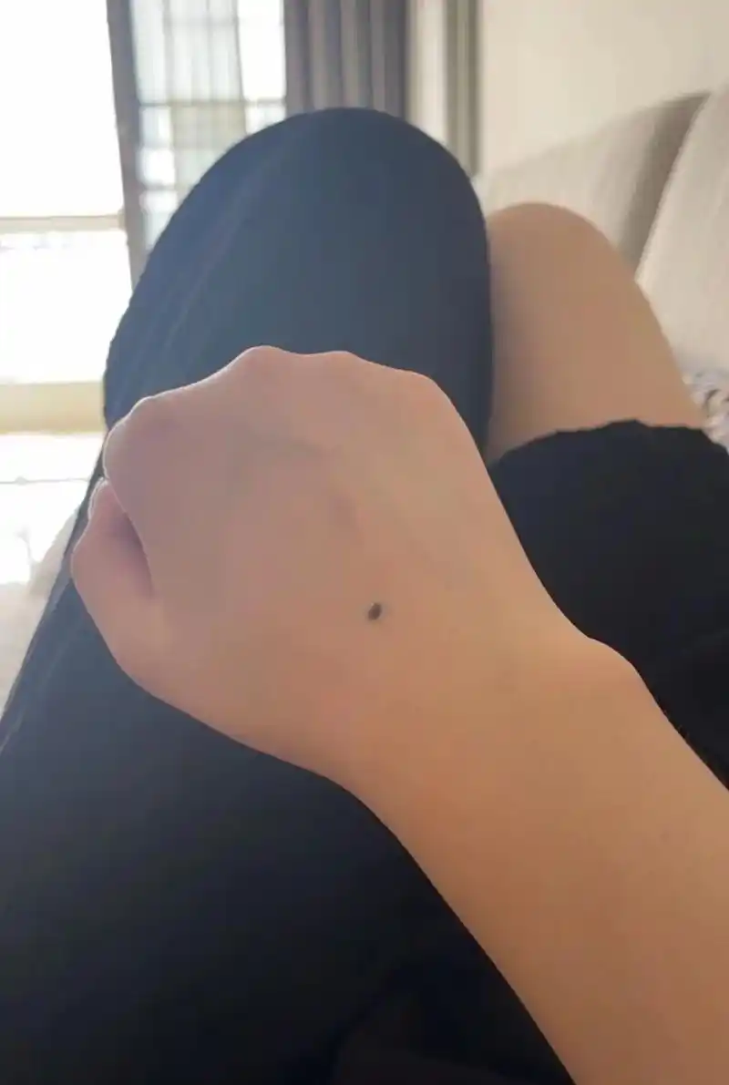 手背痣～～利后福 #玄学 #痣相 - 抖音