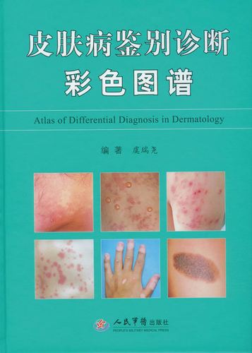 皮肤病鉴别诊断彩色图谱