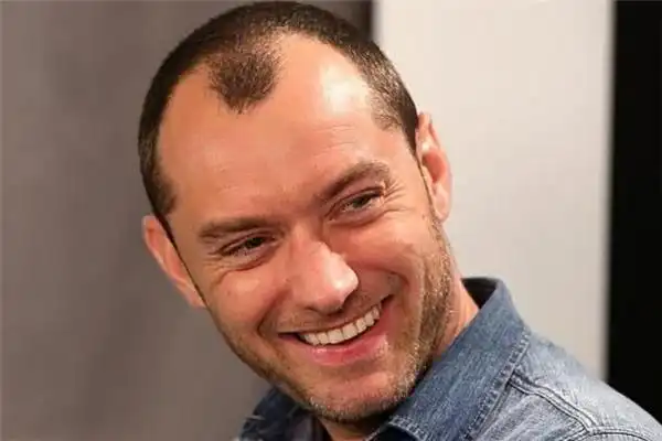 秃顶适合什么发型 中年秃顶留什么发型好