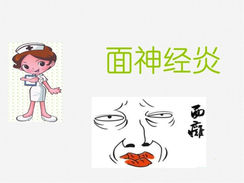 面神经炎医学课件.pptx