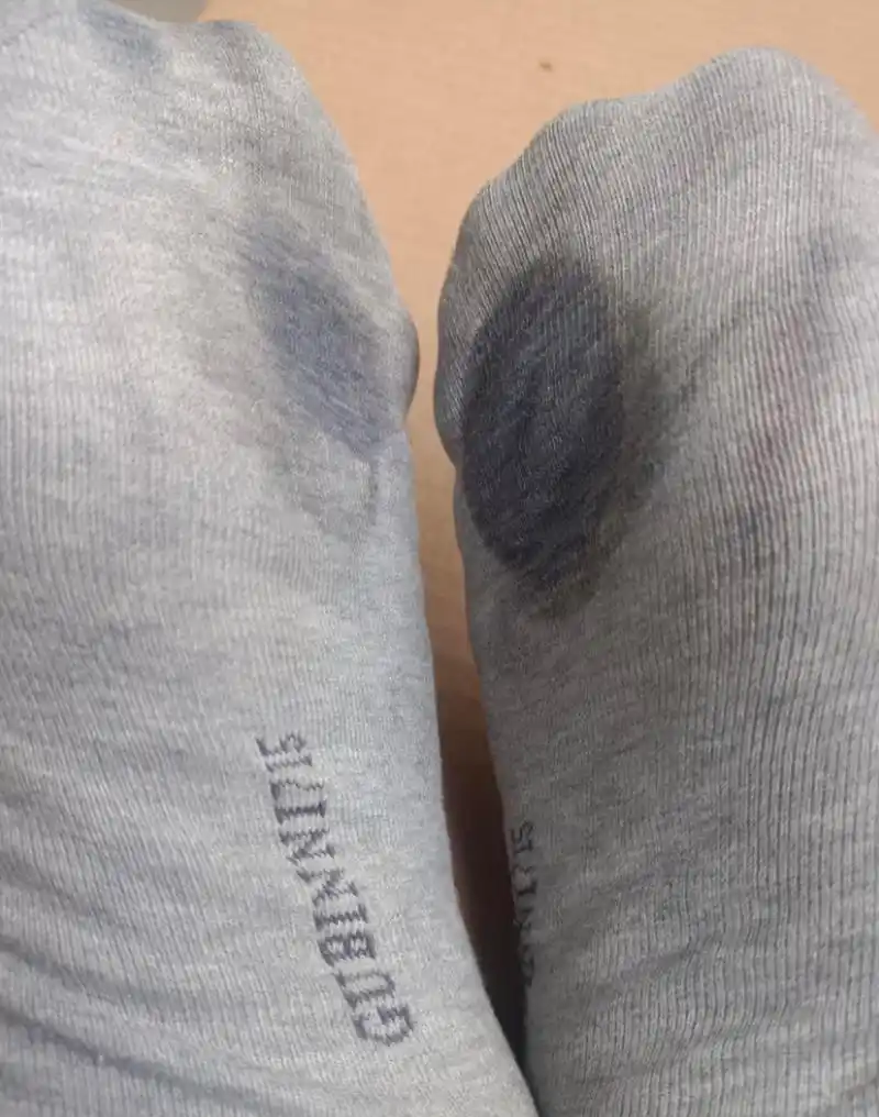 脚底那个位置老出汗是怎么回事?