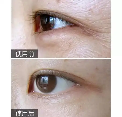 42岁和权志龙玩暧昧,成龙追她13年:她的保鲜秘密,简直是人间防腐剂!