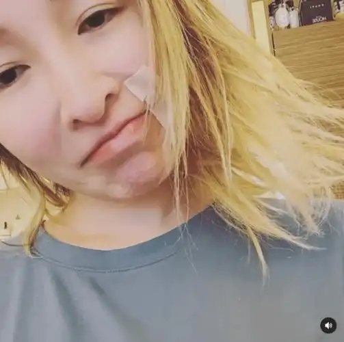 萧亚轩素颜出镜嘴角贴胶布,瘪嘴委屈情绪不佳,喊话给点时间会好_状态