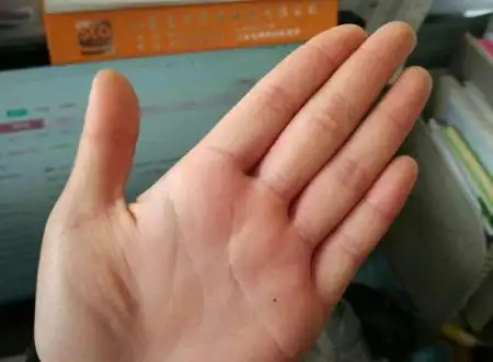女人左手手掌有痣好不好