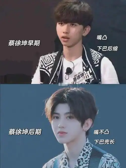 蔡徐坤成名前照片被曝,在韩国双膝下跪很卑微,整容前吓死个人?