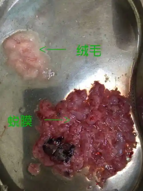 米非司酮片打胎药顺丰买药告别到处跑加微信订购