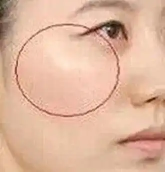 哪种面相的女人容易出轨