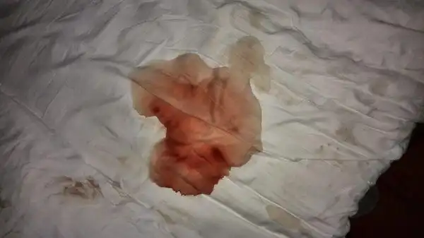 来大姨妈的是侯做的第一次,请问这是什么血